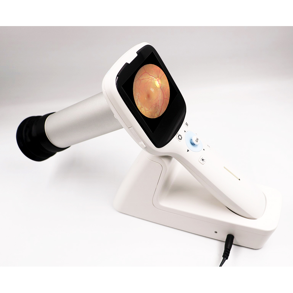 Fundus Camera Battery Solutions | TEFOO