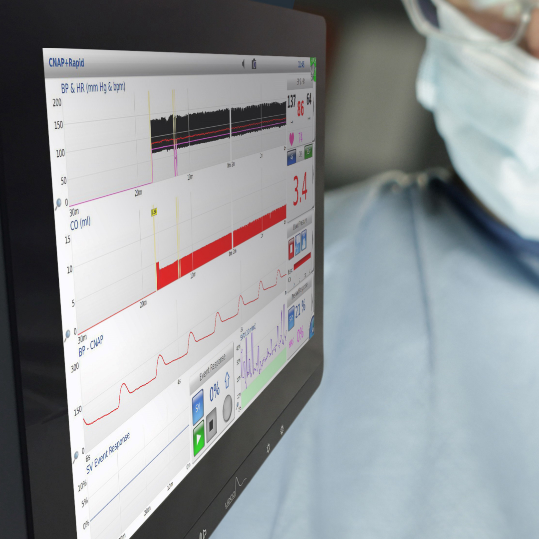 Non-Invasive Hemodynamic Monitor Battery Solutions | TEFOO